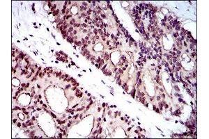 Immunohistochemistry (IHC) image for anti-Wolf-Hirschhorn Syndrome Candidate 2 (WHSC2) (AA 280-511) antibody (ABIN1846367)