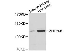Western blot analysis of extracts of various cell lines, using ZNF268 antibody.