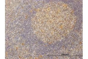 Immunoperoxidase of monoclonal antibody to SURB7 on formalin-fixed paraffin-embedded human tonsil.