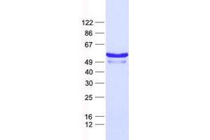 Validation with Western Blot