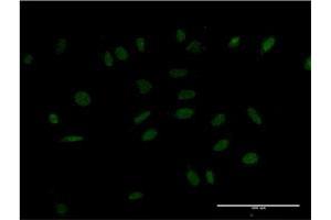 Immunofluorescence of monoclonal antibody to HMX2 on HeLa cell.