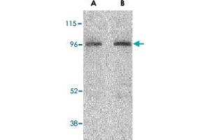 Western blot analysis of NOD2 in HeLa cell lysate with NOD2 polyclonal antibody  at (A) 2 and (B) 4 ug/mL .