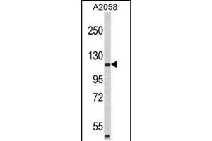 Western blot analysis of HMHA1 Antibody in A2058 cell line lysates (35ug/lane) (HMHA1 anticorps  (AA 877-903))