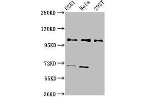 Western Blot Positive WB detected in: U251 whole cell lysate, Hela whole cell lysate, 293T whole cell lysate All lanes: PRPF40A antibody at 2. (PRPF4 anticorps  (AA 120-266))