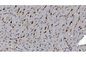 IHC analysis of Alpha B Crystallin/CRYAB using anti-Alpha B Crystallin/CRYAB antibody (ABIN7601209). (CRYAB anticorps  (AA 30-151))