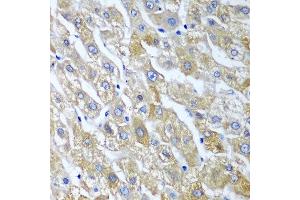 Immunohistochemistry of paraffin-embedded human liver using SGSH antibody at dilution of 1:100 (40x lens). (SGSH anticorps)