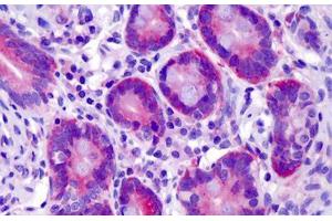 Human Small Intestine: Formalin-Fixed, Paraffin-Embedded (FFPE)