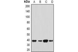 Western blot analysis of SH3GL2 expression in Hela (A), HepG2 (B), mouse brain (C), mouse testis (D) whole cell lysates. (SH3G2 anticorps)