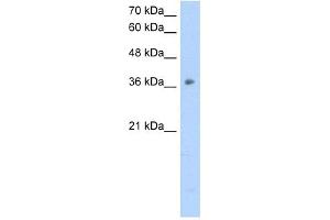 OTC antibody used at 2. (OTC anticorps  (N-Term))