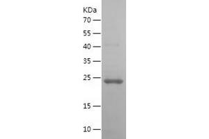 Western Blotting (WB) image for Oncostatin M (OSM) (AA 26-221) (Active) protein (His tag) (ABIN7124262)