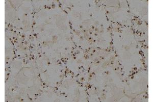 ABIN6275424 at 1/100 staining Human lung tissue by IHC-P. (ABCC13 anticorps)