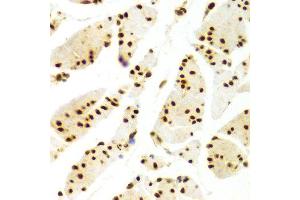 Immunohistochemistry of paraffin-embedded Human esophageal using ELAVL1 antibody at dilution of 1:100 (x400 lens).