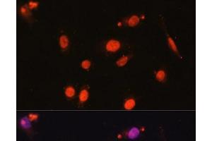 Immunofluorescence analysis of U2OS cells using DDX17 Polyclonal Antibody at dilution of 1:100. (DDX17 anticorps)