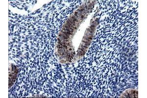 Image no. 3 for anti-Cytidine Monophosphate (UMP-CMP) Kinase 1, Cytosolic (CMPK1) antibody (ABIN1497542)