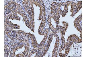 IHC analysis of CD147/Emmprin using anti-CD147/Emmprin antibody (ABIN7599997).