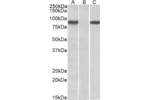 HEK293 lysate (10ug protein in RIPA buffer) overexpressing Human STAT4 (RC206892) with C-terminal MYC tag probed with ABIN571128 (1ug/ml) in Lane A and probed with anti-MYC Tag (1/1000) in lane C. (STAT4 anticorps  (AA 369-383))