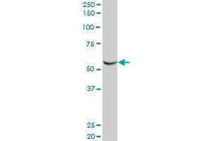 FLI1 monoclonal antibody (M03), clone 2A2. (FLI1 anticorps  (AA 1-452))