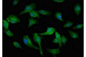 anti-Mercaptopyruvate Sulfurtransferase (MPST) (AA 102-208) antibody