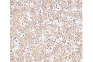 Immunohistochemistry of paraffin-embedded Human liver using GPC3 Polyclonal Antibody at dilution of 1:100 (40x lens).