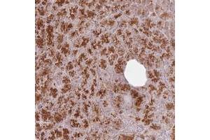 Immunohistochemical staining of human pancreas with CNPY1 polyclonal antibody  shows strong cytoplasmic and nucleolar positivity in exocrine glandular cells at 1:500-1:1000 dilution. (CNPY1 anticorps)