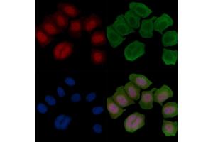 ABIN6255742 and ABIN6266454 staining Hela cells(45 min of heat-shock treatment) by IF/ICC. (Retinoblastoma Protein (Rb) anticorps  (pThr826))