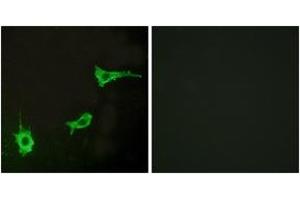 Immunofluorescence analysis of LOVO cells, using EDNRA Antibody. (Endothelin-1 Receptor anticorps  (AA 378-427))