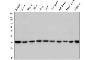 Western blot analysis of STUB1 using anti-STUB1 antibody (ABIN6719414).