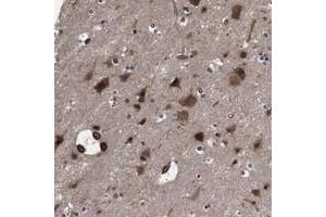 Immunohistochemical staining of human cerebral cortex with PAWR polyclonal antibody  shows strong cytoplasmic and nuclear positivity in neuronal cells and glial cells at 1:50-1:200 dilution. (PAWR anticorps)