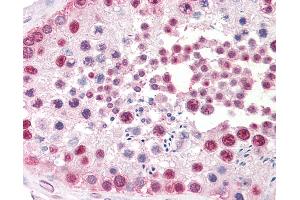 Anti-TSPY1 / TSPY antibody IHC staining of human testis.