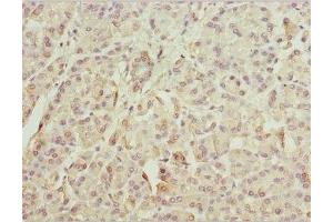 Immunohistochemistry of paraffin-embedded human pancreatic tissue using ABIN7176057 at dilution of 1:100 (ZFYVE1 anticorps  (AA 1-280))