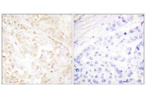 Immunohistochemistry (IHC) image for anti-X-Ray Repair Complementing Defective Repair in Chinese Hamster Cells 6 (XRCC6) (C-Term) antibody (ABIN1848905) (XRCC6 anticorps  (C-Term))