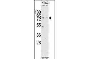 Western blot analysis of anti-JHDM1a/FBXL11 Antibody pre-incubated with(right lane) and without(left lane) blocking peptide in Jurkat cell line lysate. (KDM2A anticorps  (C-Term))