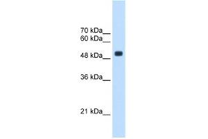 WB Suggested Anti-CXorf34 Antibody Titration:  2. (TRMT2B anticorps  (Middle Region))