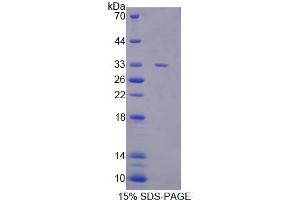 SDS-PAGE analysis of Mouse CASC5 Protein.