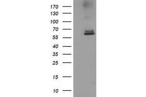 Western Blotting (WB) image for anti-Acyl-CoA Thioesterase 12 (ACOT12) antibody (ABIN1496416) (ACOT12 anticorps)