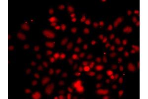 Immunofluorescence analysis of A549 cell using RRAGC antibody. (GTR2 anticorps)