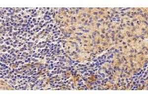Detection of IL6 in Human Spleen Tissue using Monoclonal Antibody to Interleukin 6 (IL6)