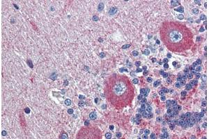 Human Brain, cerebellum: Formalin-Fixed, Paraffin-Embedded (FFPE)