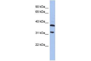 WB Suggested Anti-ASPA Antibody Titration: 0. (ASPA anticorps  (Middle Region))