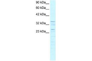 ZNF385 antibody used at 0. (ZNF385A anticorps  (C-Term))