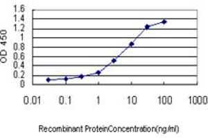 Detection limit for recombinant GST tagged IRAK3 is approximately 0. (IRAK3 anticorps  (AA 497-596))
