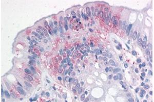 Human Colon: Formalin-Fixed, Paraffin-Embedded (FFPE)