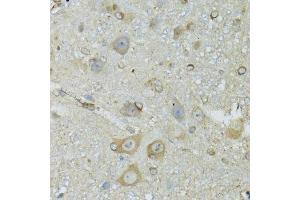 Immunohistochemistry of paraffin-embedded mouse brain using CRYM antibody.