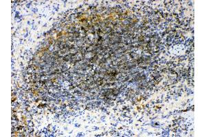 IHC analysis of GAS 6 using anti- GAS 6 antibody .