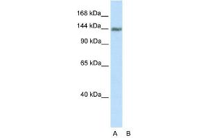 Western Blot showing TIMELESS antibody used at a concentration of 1-2 ug/ml to detect its target protein. (TIMELESS anticorps  (C-Term))