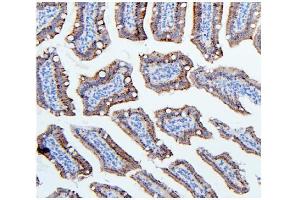 IHC analysis of Hexokinase 1/HK1 using anti-Hexokinase 1/HK1 antibody (ABIN7600259).