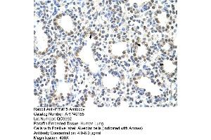 Rabbit Anti-PRMT5 Antibody  Paraffin Embedded Tissue: Human Lung Cellular Data: Alveolar cells Antibody Concentration: 4. (PRMT5 anticorps  (N-Term))