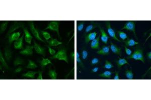 ICC/IF Image CD71 antibody [N2C1], Internal detects CD71 protein at cytoplasm by immunofluorescent analysis.