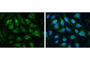 ICC/IF Image CD71 antibody [N2C1], Internal detects CD71 protein at cytoplasm by immunofluorescent analysis. (Transferrin Receptor anticorps)