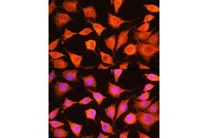 Immunofluorescence analysis of L929 cells using PHKG2 Rabbit pAb  at dilution of 1:100 (40x lens).